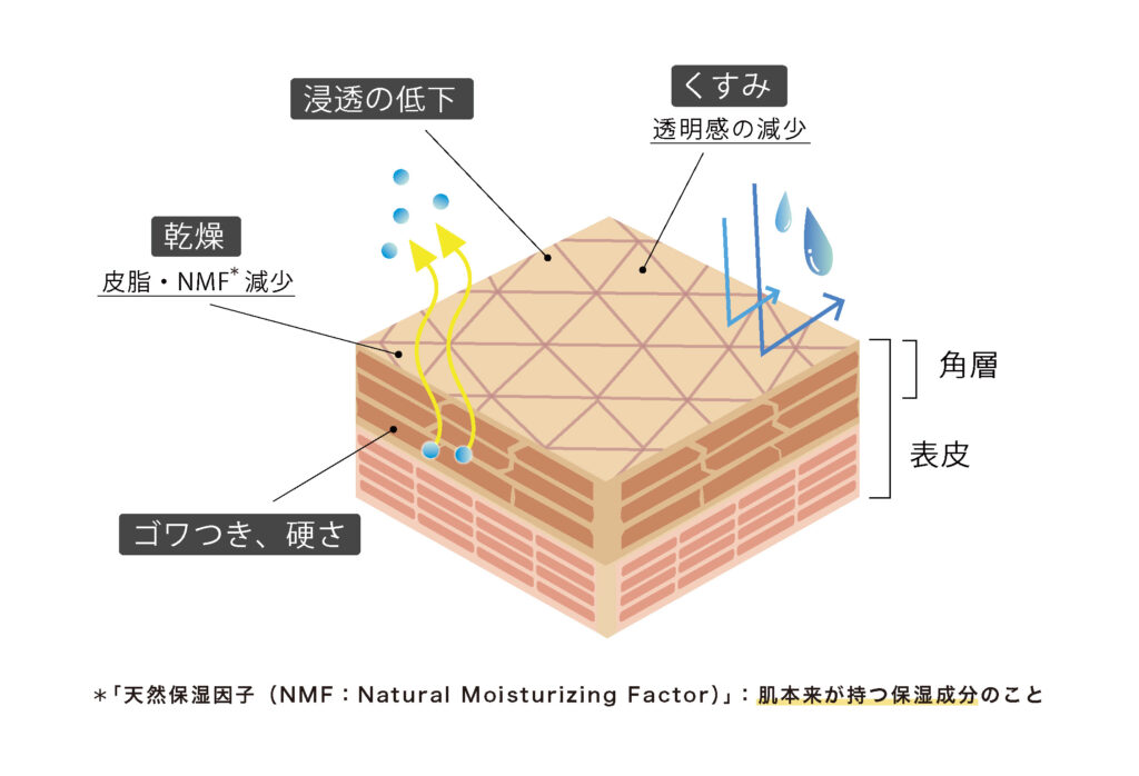 フリーズ角質の図