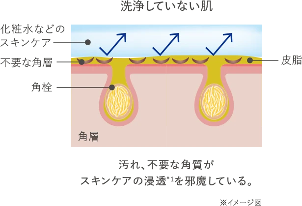アクアレーベル エステ洗顔ジェルの「プレスキンケア効果のメカニズム」の説明の洗顔していない肌の肌のイラスト