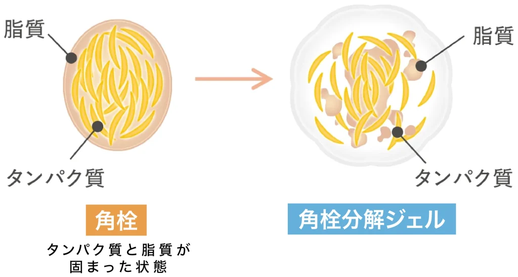 アクアレーベル エステ洗顔ジェルの特徴、「角栓分解処方」の説明イラスト