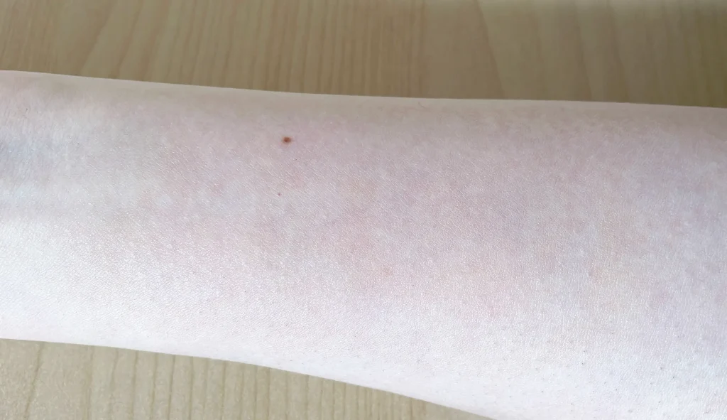 アクアレーベル エステ洗顔ジェルでベースメイクを落とした後の腕の画像